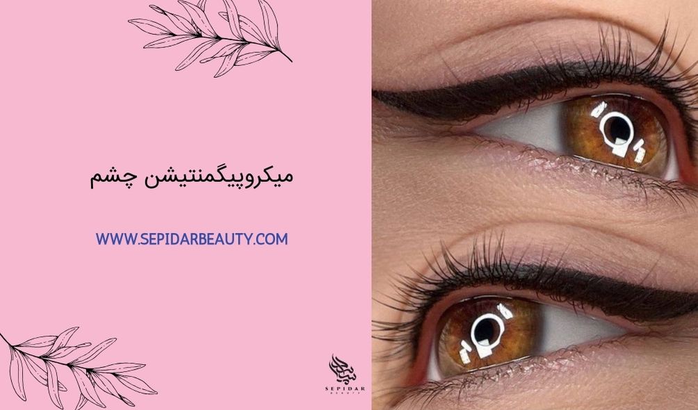 میکروپیگمنتیشن چشم-سپیدار بیوتی