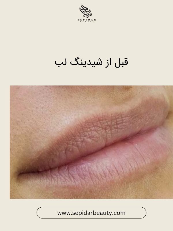 انتخاب رنگ شیدینگ لب برای پوست‌های تیره
