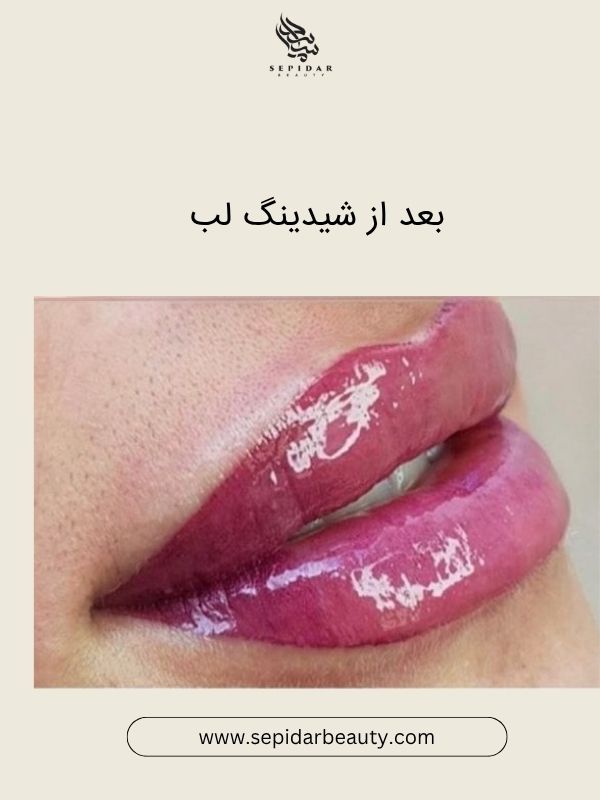 انتخاب رنگ شیدینگ لب بر اساس فرم لب‌ها