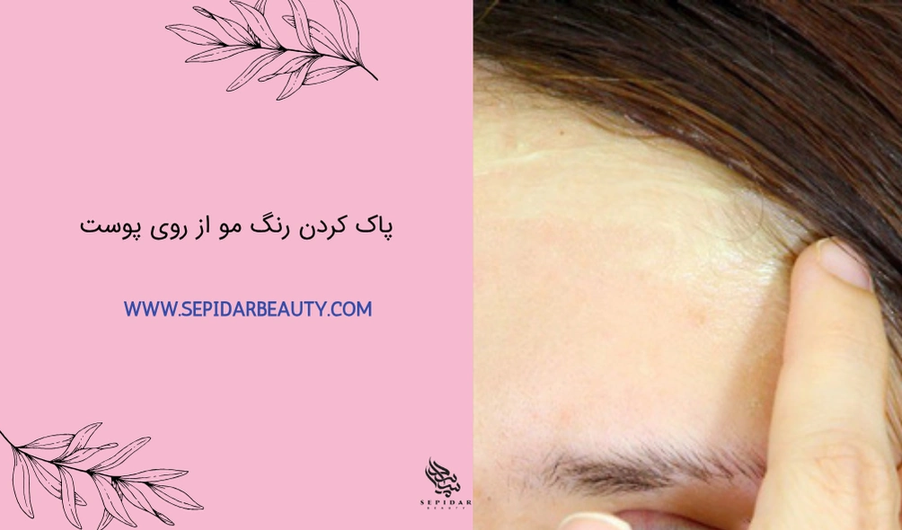پاک کردن رنگ مو از روی پوست