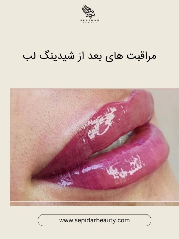 شیدینگ لب چیست