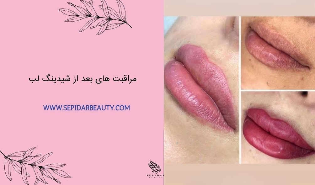مراقبت های بعد از شیدینگ لب