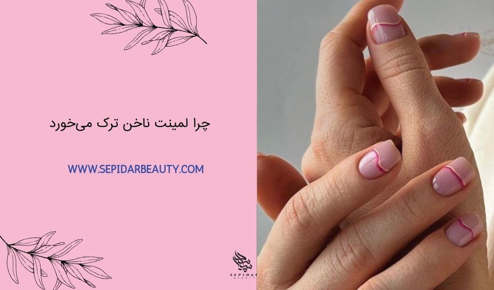 چرا لمینت ناخن ترک می خورد
