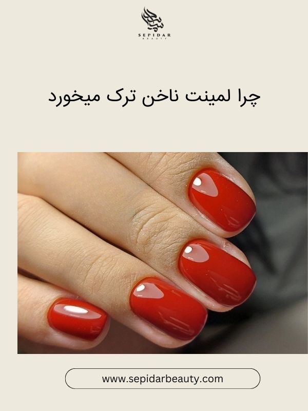 دلایل ترک خوردن لمینیت ناخن