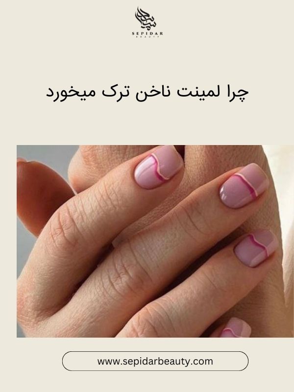 مراحل انجام لمینت ناخن