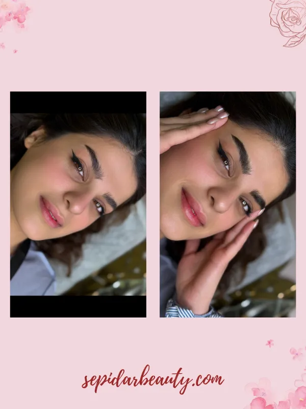 نمونه کار فیبروز ابرو 1