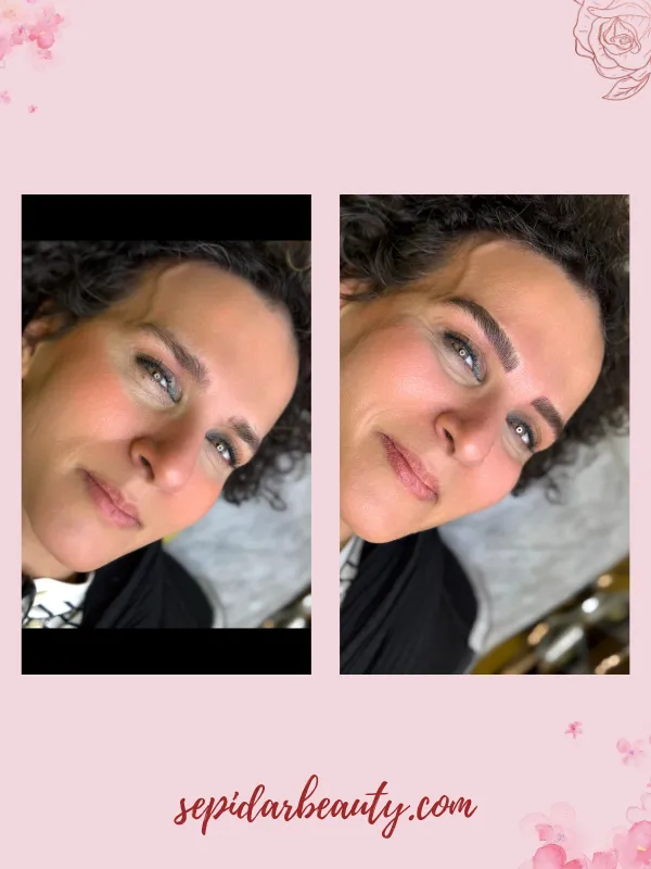 نمونه کار فیبروز ابرو